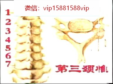 颈椎病诊断治疗法专辑 颈椎病康复养护操 推拿手法视频集锦 2.8G(图72)